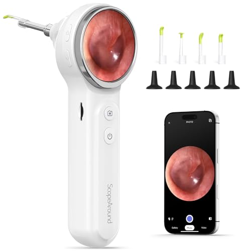 ScopeAround Digital Otoscope with Light