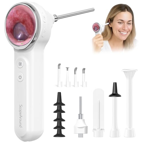 ScopeAround Otoscope 1080P FHD Ear Camera