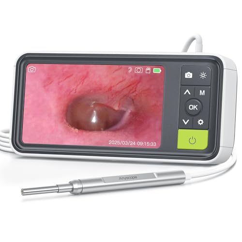 AnyScope 1080P Digital Otoscope with Screen
