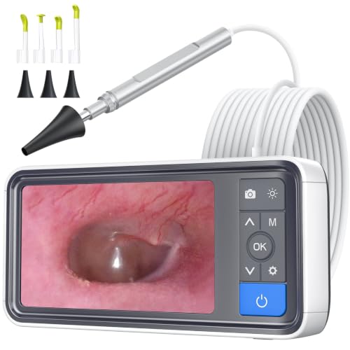 ScopeAround Otoscope Ear Camera with Screen