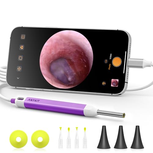 Anykit Digital Otoscope with Gyroscope