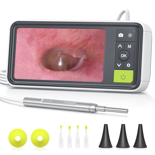 Anykit Digital Otoscope with Screen